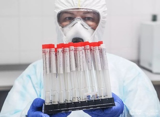 “Асака банк” ва  “Ипак йўли банк” филиали ходимларида коронавирус аниқланди