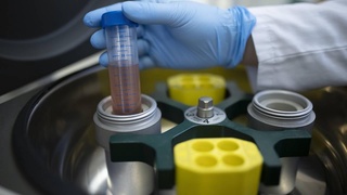 Olimlar ildiz hujayralaridan yurak organoidini yaratishdi