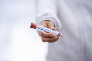 Нима учун ПЦР тестлари айрим ҳолларда коронавирусни аниқлай олмайди?