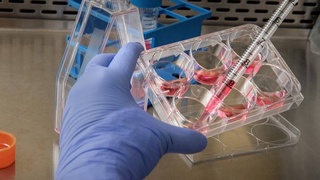 Первый в мире пациент получил лекарство от рака на основе вируса