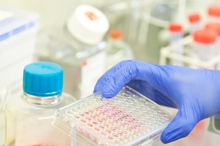 Йил бошидан буён дунё бўйича вабога чалинганлар сони маълум қилинди