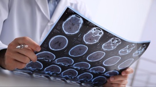 Шифокор саратонни қўзғатувчи маҳсулотларни санаб ўтди