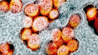 Лихорадка «поможет» при коронавирусе?