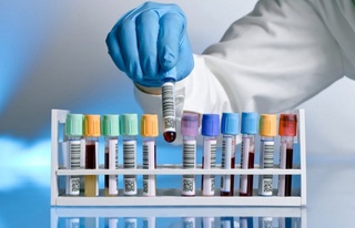 ДДСҰ дәрілерге төзімді туберкулезді және С гепатитін емдеу туралы шұғыл хабарлама жариялады