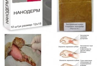 Ўзбекистонда куйган яра ва чуқур яраларни даволовчи «Нанодерм» - имплант-плёнкалари яратилди