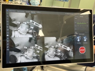 Өзбекстанда биринши мәрте робот жәрдеминде бас мий биопциясы орынланды