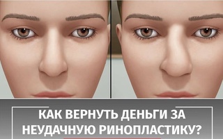 Как вернуть деньги за неудачную ринопластику?