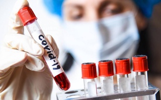 Coronavirus update: 2568 cases in Uzbekistan, 12 patients’ state is serious