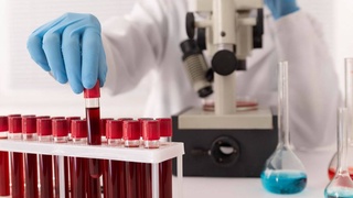 Названа группа крови, которая грозит проблемами со здоровьем