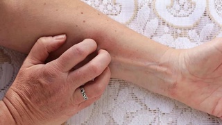 Названы симптомы «омикрона» на коже, которые нельзя игнорировать