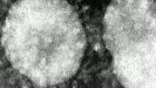 Ученые: назван реальный цвет коронавируса