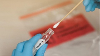 Представлен тест для самостоятельного обнаружения COVID-19