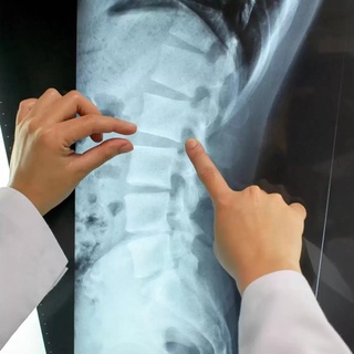 Орқа мия нервларини тиклашга ёрдам берадиган дори топилди