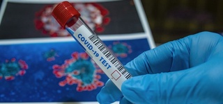 Коронавирус қачон ортга чекинади? 