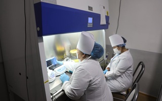 Бачадон бўйни саратонига ўзингизни бепул текширтиринг!