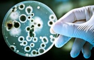 ЖССТ дунёда холера вабоси кенг тарқалишидан хавотирда