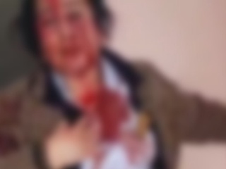 Самарқанддаги шифохонада ўз ҳамкасбларига тан жароҳати етказган фуқарога нисбатан жиноят иши қўзғатилди