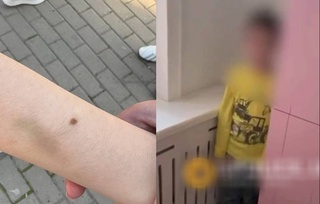 Toshkentdagi bogʻchada tarbiyalanuvchi bogʻcha administratori tomonidan kaltaklandi