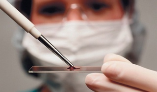 Ёз яқин: Жазирамада қон қуюқлашиши қанчалик хавфли?