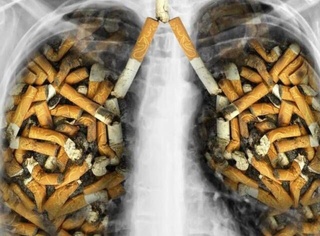 Сигарет тутуни ҳар тўрт сонияда бир кишининг ҳаётига нуқта қўймоқда