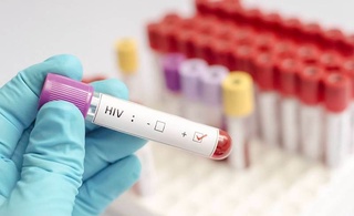 Хориждан қайтганларни мажбурий ОИВ текширувидан ўтказиш кўзда тутилган қонун лойиҳаси Сенатга юборилди