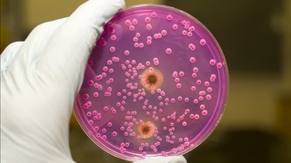 Замбуруғли касалликлар қандай пайдо бўлади?