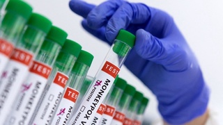 Маймун чечаги эпидемияси қачон тугайди?