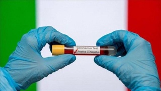 Коронавирусга чалиниш ҳолатини қисқа фурсатда аниқловчи экспресс-тест яратилди