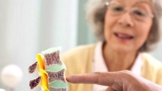 Остеопороз касаллигининг олдини олиш учун нима қилиш керак?