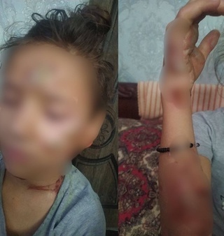 Buxoroda ayol qizining badaniga qizigan kapgir bosdi