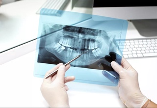 Parodontitni davolashga mo'ljallangan yangi vosita ishlab chiqildi