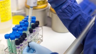 «Абу Сахий», «Мегапланет» ва “Toshkent city”да коронавирус аниқланди