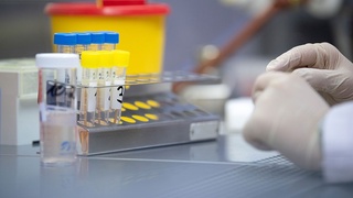 «Коронавир» препарати сотувга чиқарилмоқда