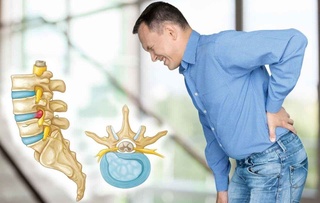 Disk churrasining oldini olish o‘z qo‘limizda