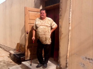 Revmatoid poliartrit kasalligi sabab qiynalib kelayotgan tuproqqal'alik fuqaroga yordam ko'rsatildi