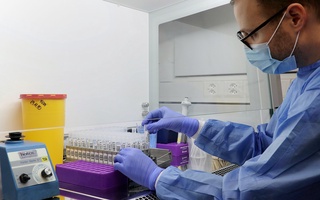 Mamlakatimizga “hindcha” shtamm ham kirib keldimi?