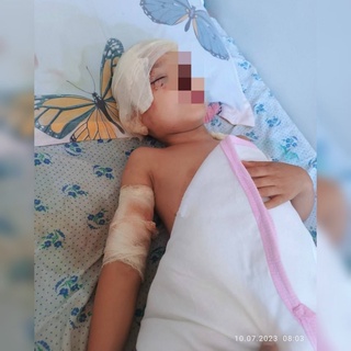 Андижонда итлар галаси талаган боланинг аҳволи ҳақида маълумот берилди