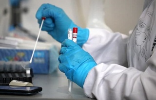 Россияда ПЦР-тест натижасининг амал қилиш муддати қисқартирилди