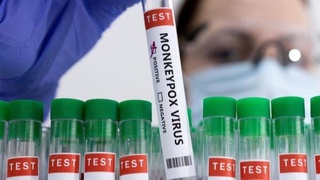 ЖССТ: Маймун чечагини юқтирган беморлар сони 260 нафарга яқинлашди. Яна 120 киши шубҳа остида 