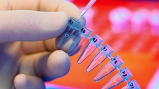 Қашқадарёда илк бор оққонга чалинган болаларни халқаро стандартлар асосида ташхислаш йўлга қўйилди