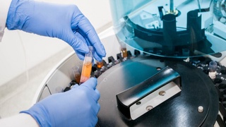 O'pka trombozini davolaydigan dori vositasi ishlab chiqildi