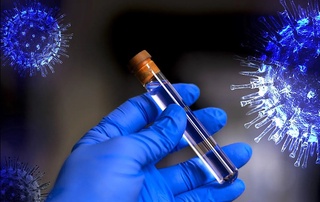 ЖССТ коронавирусни даволаш бўйича тавсияларини янгилади