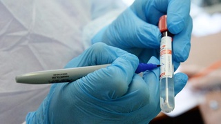 Coronavirus case in Uzbekistan increases