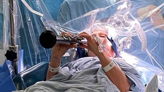 Пациентка сыграла на кларнете в ходе операции на головном мозге