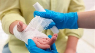 Робота для лечения ожогов создали в Австралии: он печатает ткани из клеток кожи пациента