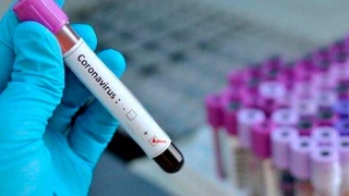 Oʻzbekistonda 555 fuqaro koronavirusga chalingan, 10 bemorning ahvoli ogʻirligicha qolmoqda