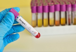 Перунинг 20 та ҳудудида денге иситмаси тарқалиши сабабли фавқулодда ҳолат эълон қилинди