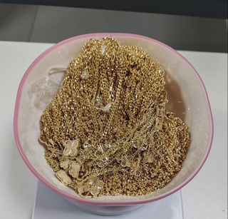 Bojxonadan zargarlik buyumlarini jinsiy aʼzolariga yashirib olib oʻtmoqchi boʻlgan shaxs ushlandi