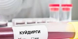 Тошкент шаҳрида куйдирги касаллиги тарқалгани ҳақидаги хабарлар тасдиқланмади