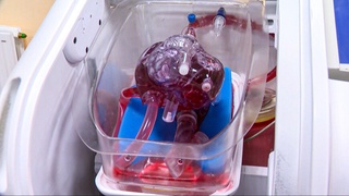 Қазақстандық дәрігерлер адам ағзасын трансплантациялауда тиімділігі жоғары құрылғы ойлап тапты